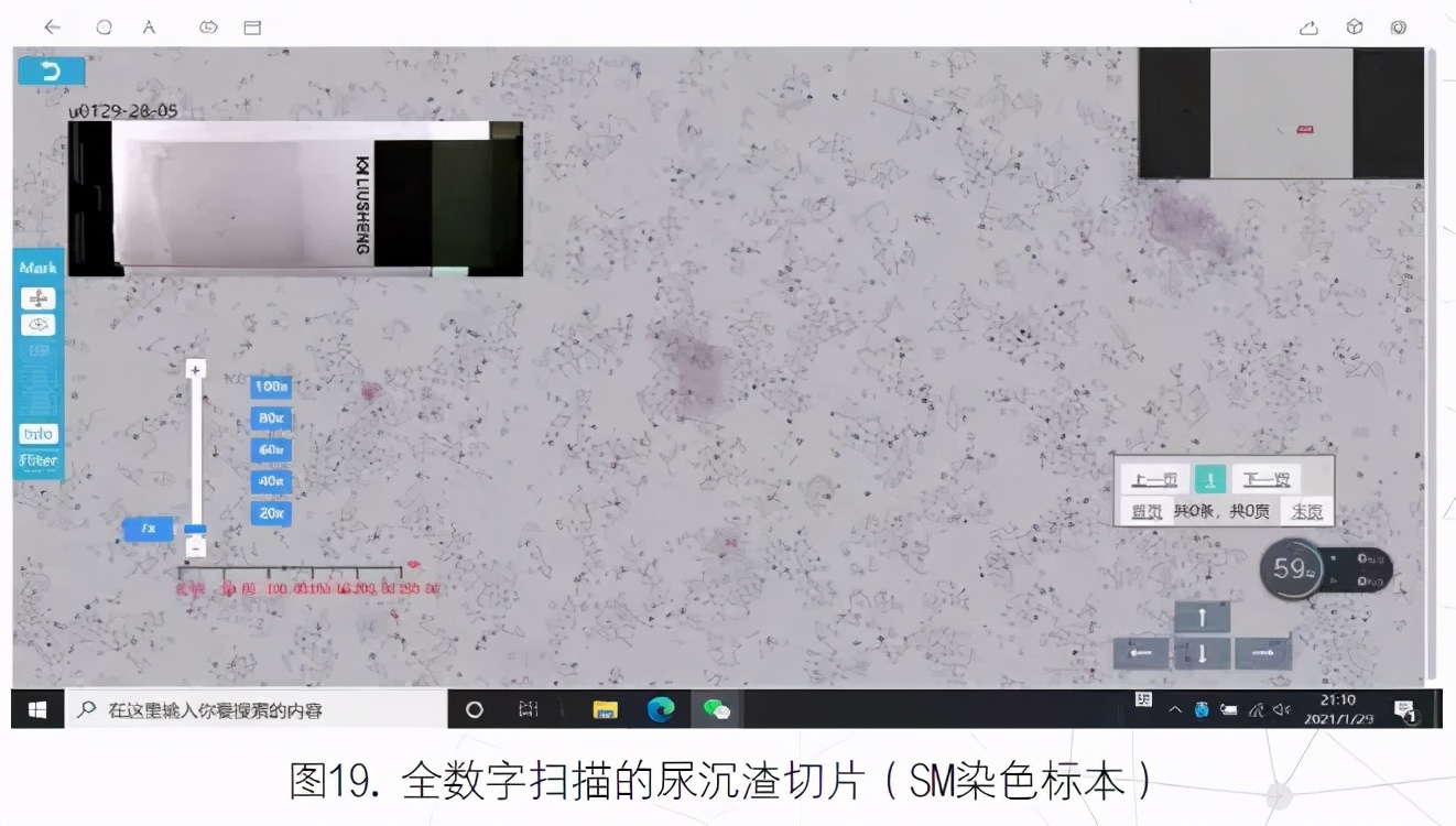 尿液有形成分分析的应用进展,尿液染色方法