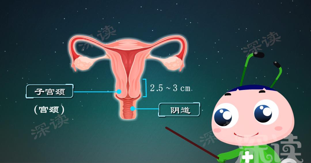 乖乖女竟得宫颈炎?宫颈炎就是淋病?动漫揭秘宫颈炎发病机制!燃