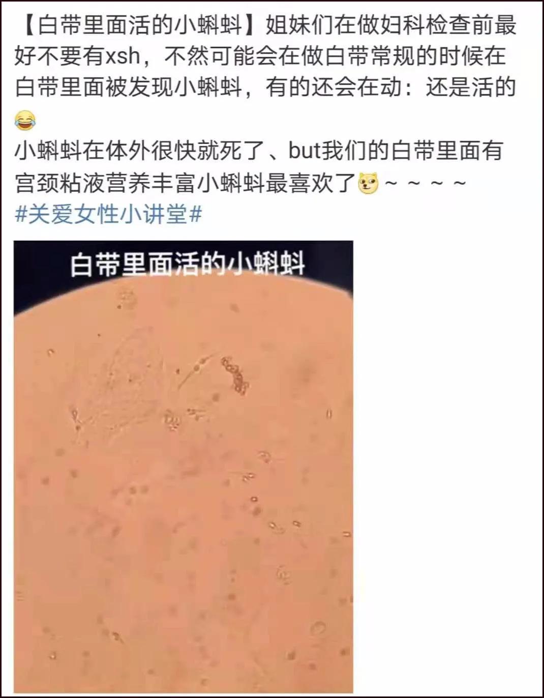 第一次做妇科检查什么感觉,女生第一次妇科检查