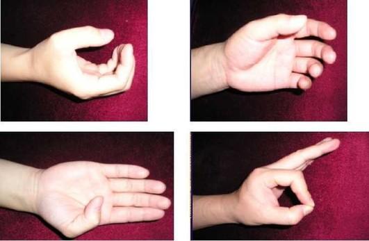 防治腱鞘炎最好的动作,预防腱鞘炎的关键有哪些