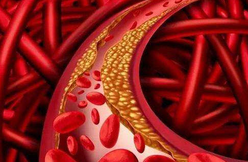 铁锅炒菜有效补铁这说法靠谱吗,铁锅炒菜怎么补铁效果最好