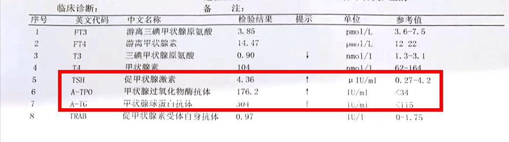 桥本甲减服药治疗效果仍然不佳，心率达到110次/分，真无法可治？