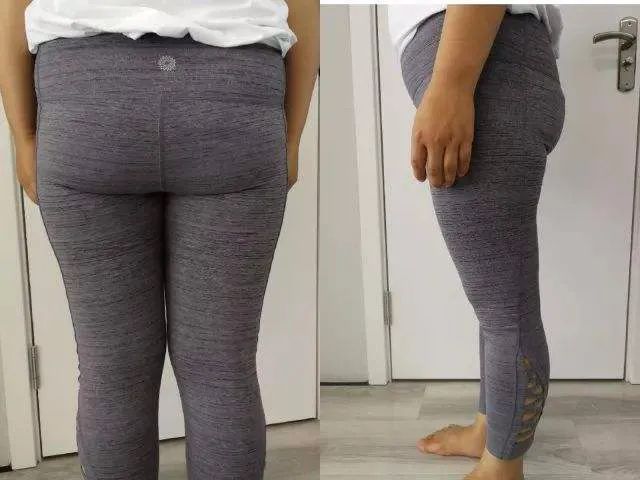 臀部变小紧致的办法,臀部松垮