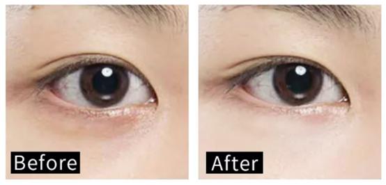 学她这样保养，50岁都不会有黑眼圈，秘密全靠这支「小黑管」