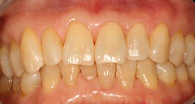 狗狗洗牙的良心忠告,医生忠告千万别洗牙