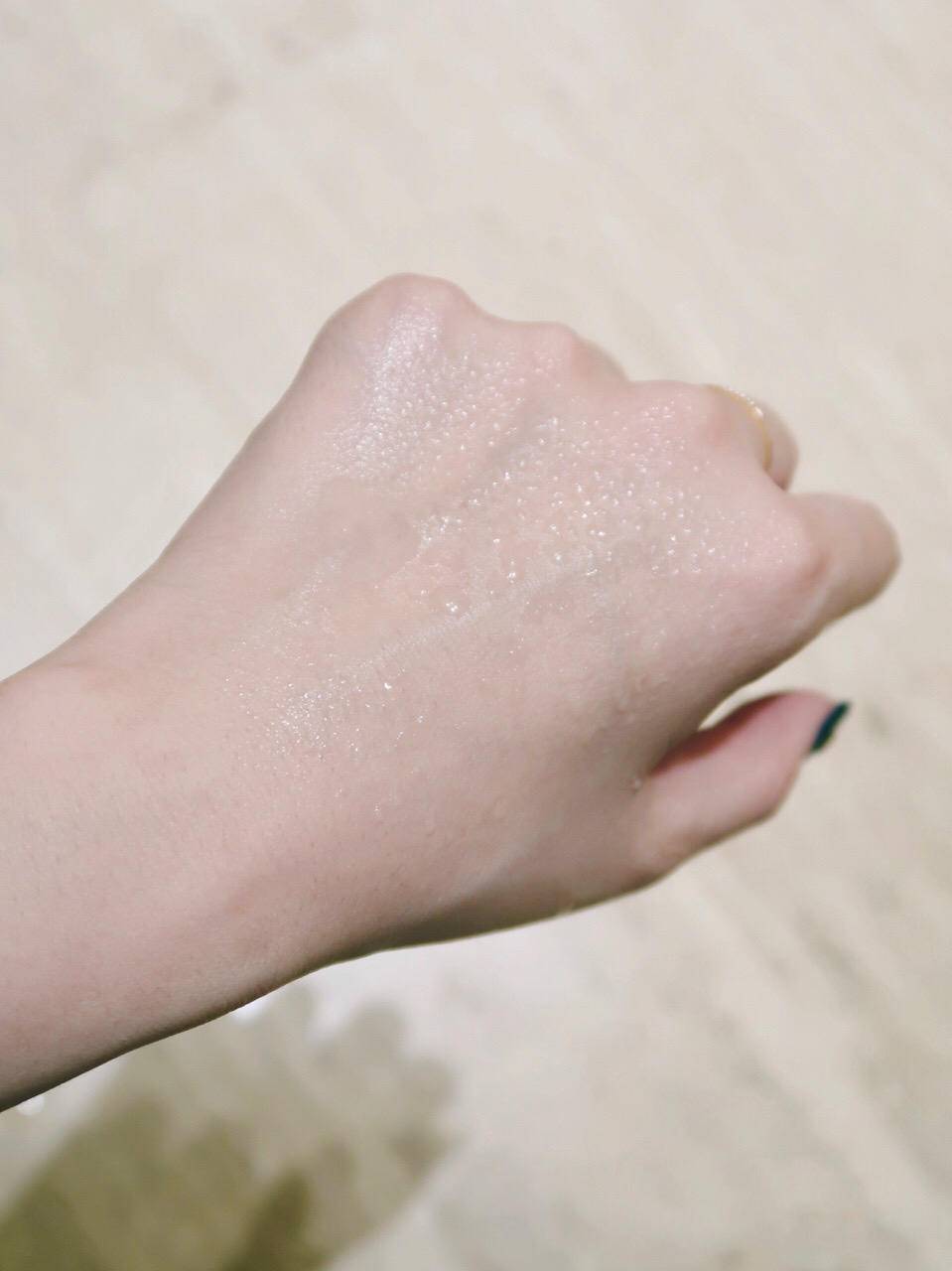 晒后皮肤疼如何快速修复,晒伤后出的晒痕如何处理