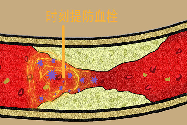 睡觉腿抽筋原因可能不仅仅是缺钙,睡觉突然腿抽筋并非是缺钙
