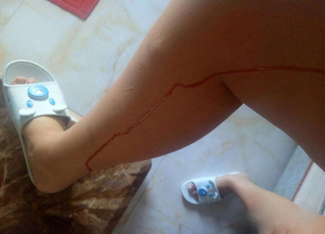 一旦孕期见红，真的代表胎儿即将不保吗？专家表示：要区分情况