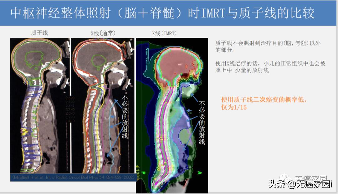 质子治疗手术适合大型肿瘤,肿瘤不能根治吗