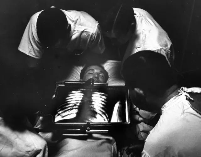 用X光脱毛、试鞋、选美，那些玩X光的勇士最后都怎样了？