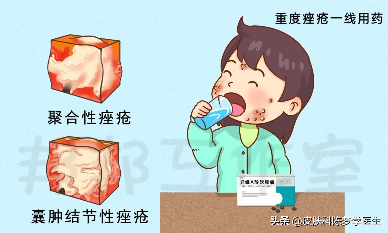 脸上青春痘用什么药膏,青春痘祛痘印推荐药物有哪些