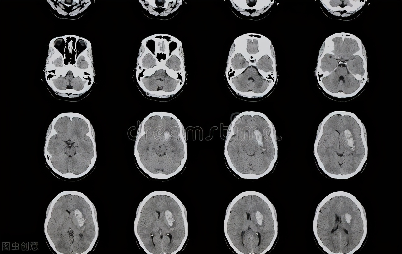 经常头痛却查不出原因怎么办,常年头痛但是查不到病因怎么办