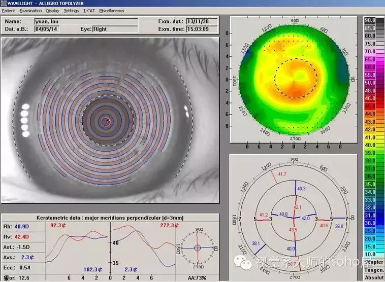 如何选择角膜塑形镜的品牌,怎么选角膜塑形镜的参数