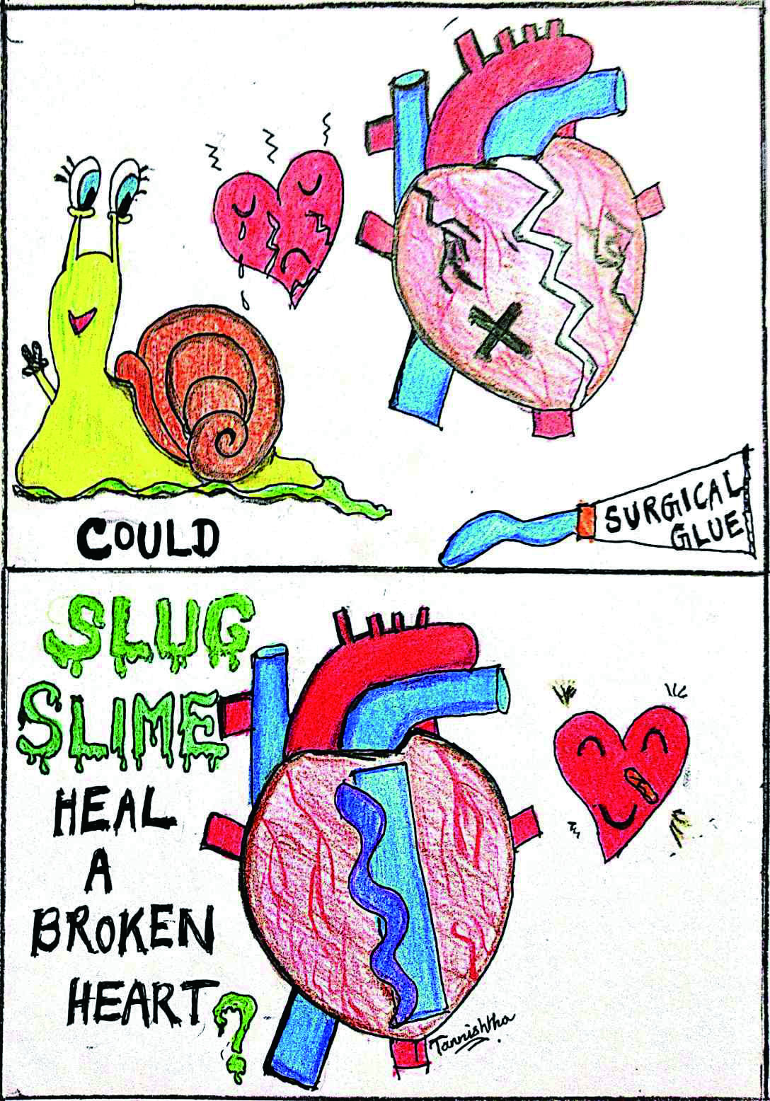 医用胶水缝合伤口多久能好,术后用胶水粘合的伤口多久会消失