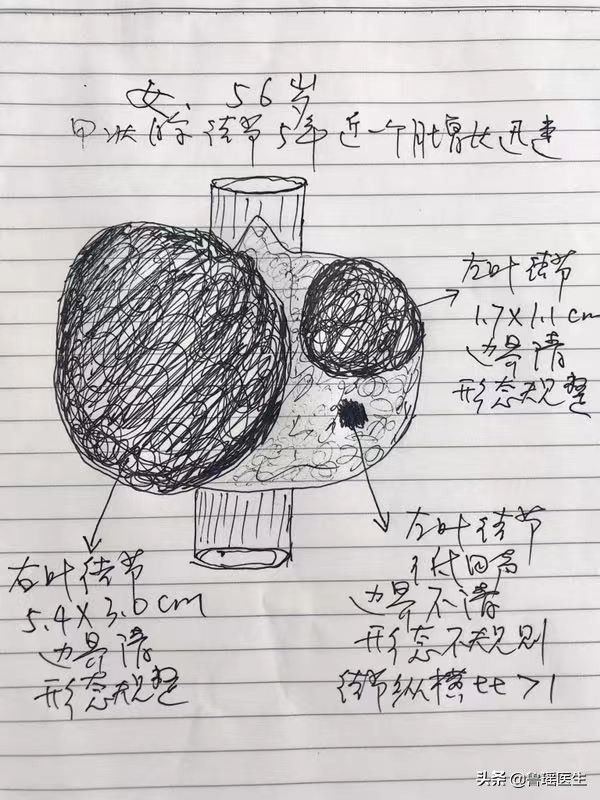 拖延回避、吃中药转了一圈后这位甲状腺结节患者还是选择了手术