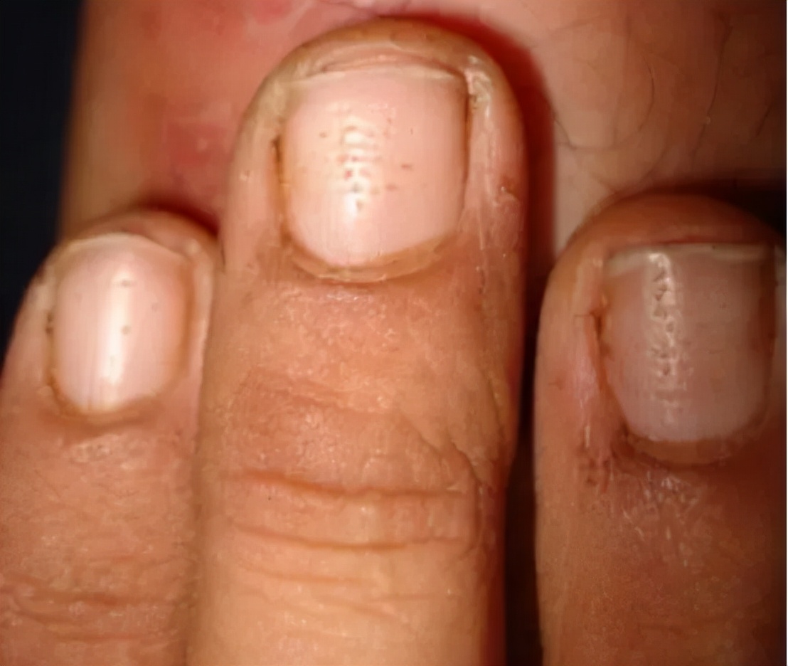 美甲的指甲怎么养护才好看,如何不做美甲就能让指甲变得精致