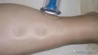 下身胖腿粗的女孩要怎么瘦,女生如何改善上半身太壮