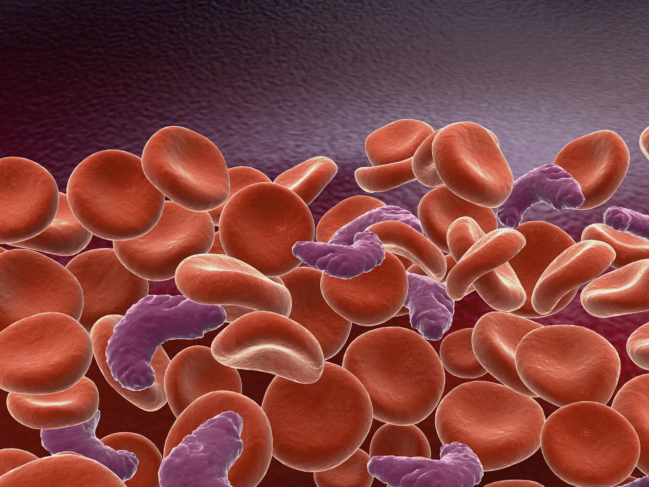 儿童白血病怎么能提前查出来,孩子判断白血病最简单方法