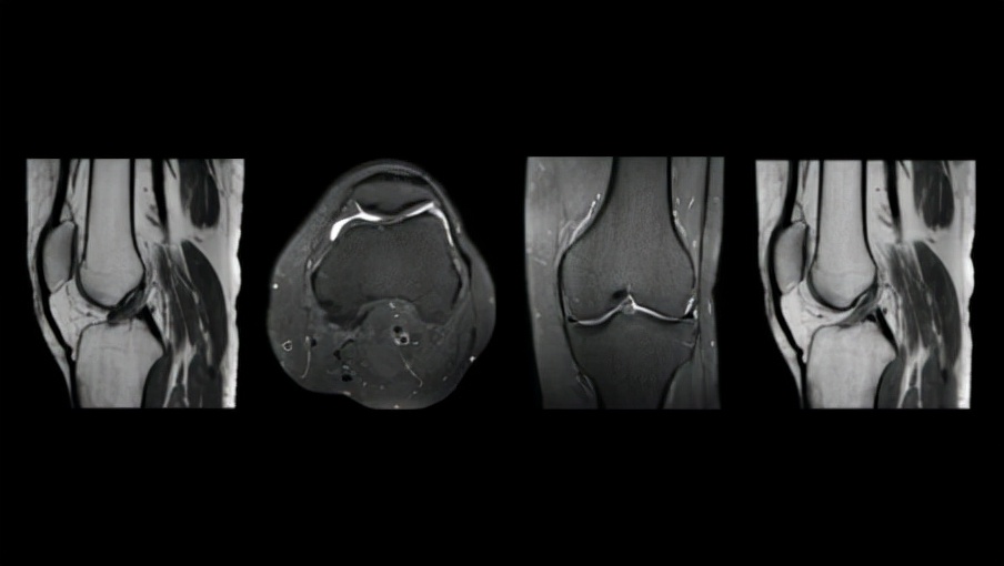 飞利浦3.0核磁共振扫描技术,飞利浦3.0磁共振简介