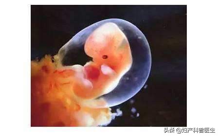 阴道流血14天，孕妈妈说：我要保胎，留住这个“坚强”的孩子