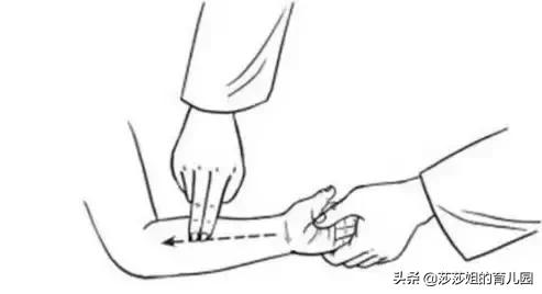 痄腮的发病规律,痄腮如何引起的