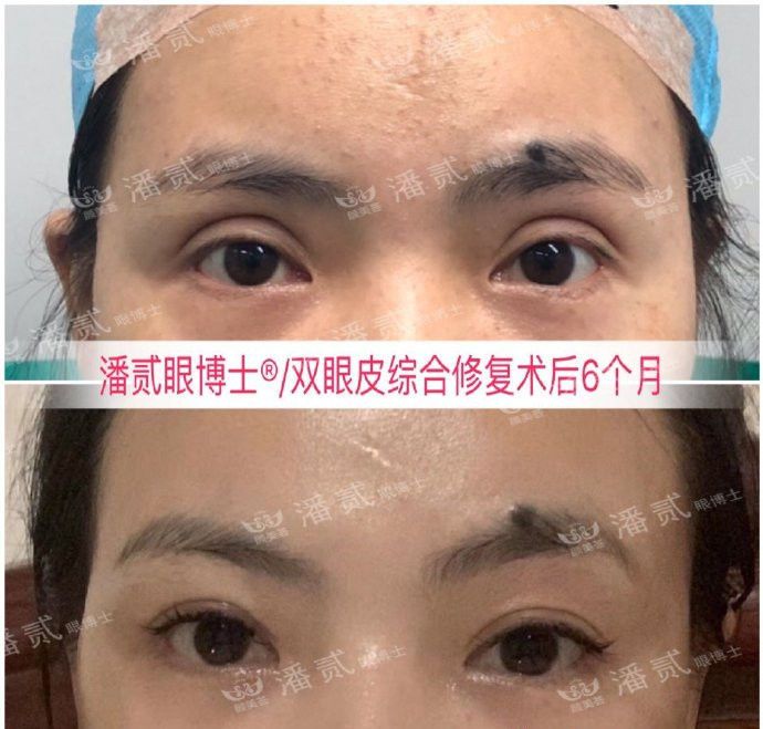 双眼皮凹陷眉毛怎么设计好看,凹眼窝适合什么眉型