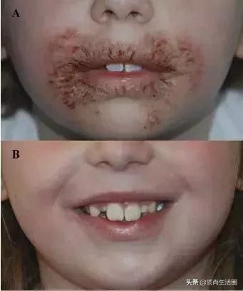 婴幼儿湿巾测评可爱多,婴儿湿巾不合格品牌曝光