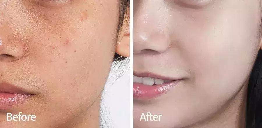 沈梦辰美妆精华,沈梦辰全靠这款精华液逆袭变白