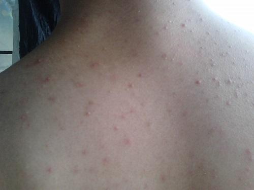 几块钱的硫磺皂解决家里的大问题,几块钱的硫磺皂能不能用