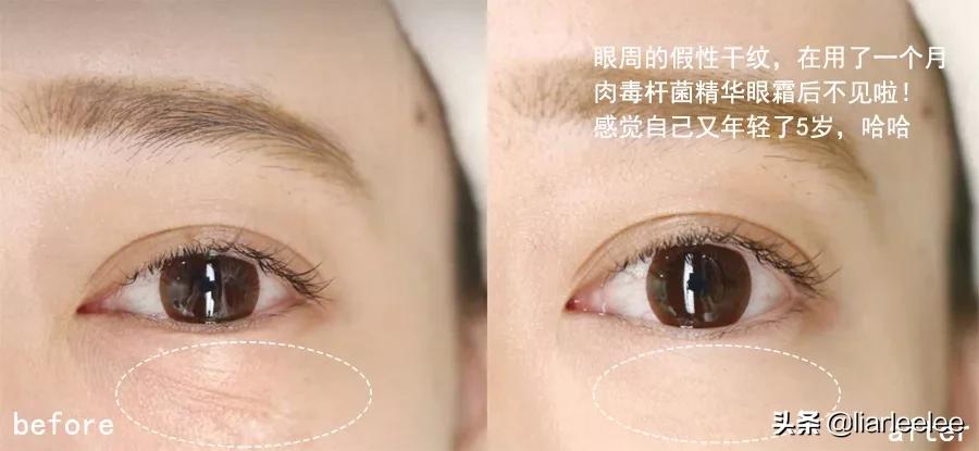 去细纹哪款眼霜值得入手百元内,又方便又好用的一款眼霜