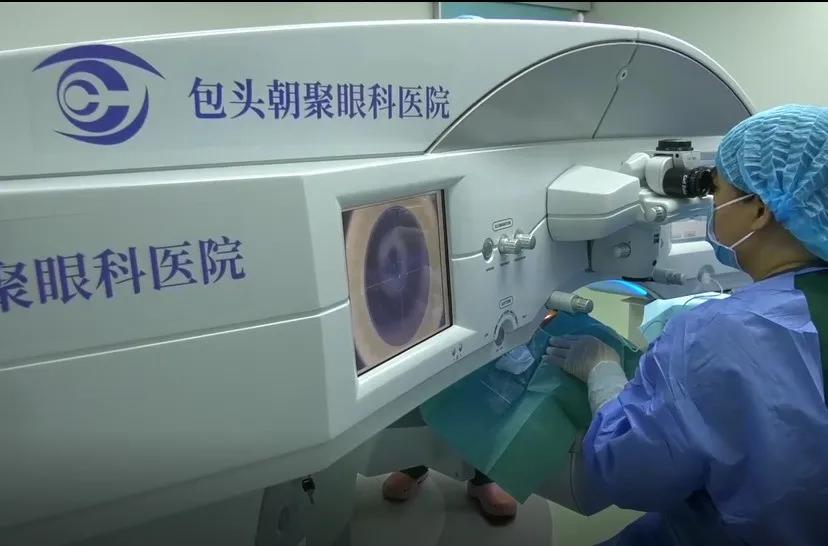 包头朝聚眼科飞秒手术,朝聚眼科医院公益直播