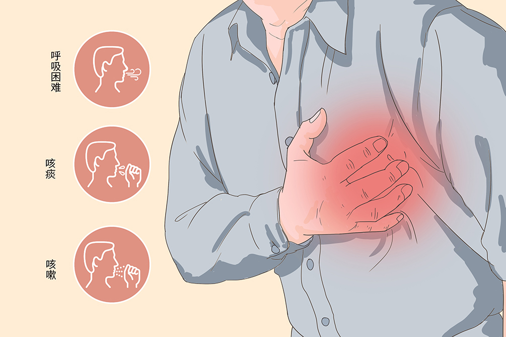 粘多糖贮积症1岁宝宝,黏多糖贮积症多少岁看出来的