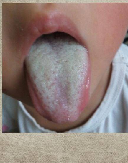 孩子脾胃不好还拉羊粪便吃什么,孩子脾胃虚拉羊屎蛋怎么调理