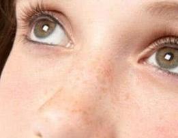 炎热的夏天有哪些小妙招,炎热的夏天如何防止晒黑