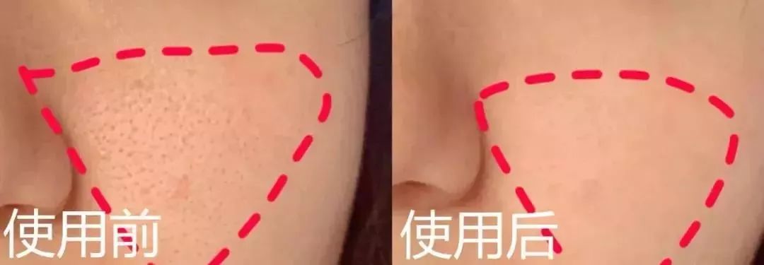 收缩毛孔提亮肤色李佳琦推荐,李佳琦缩毛孔控油