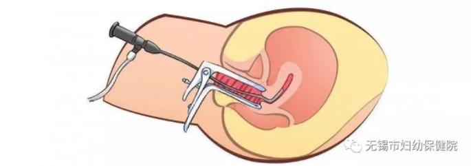 妇幼保健院宫腔镜哪个医生好,关于妇幼的新闻