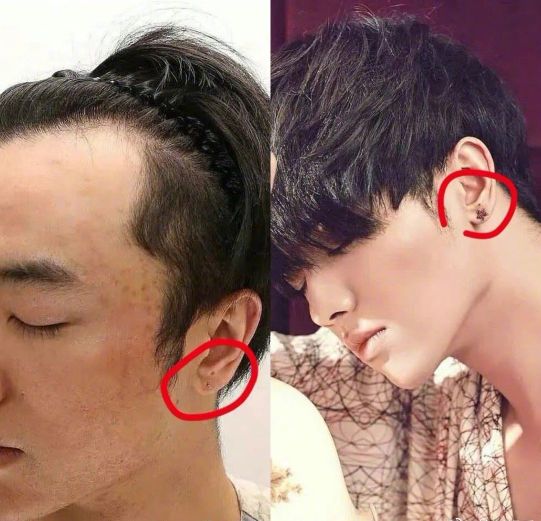 华晨宇植发成功了吗,华晨宇植发图片是真的吗