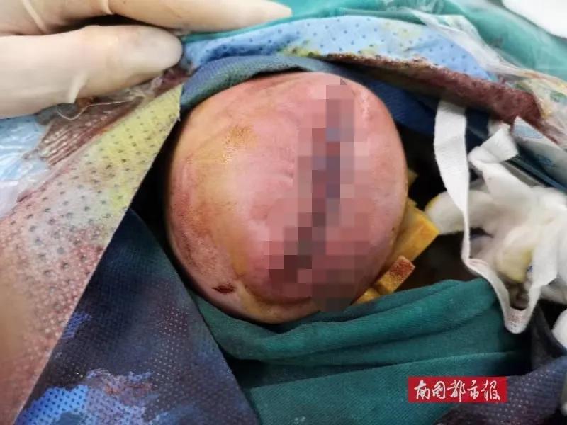 心疼妈妈生产的宝宝,心疼生孩子的妈妈