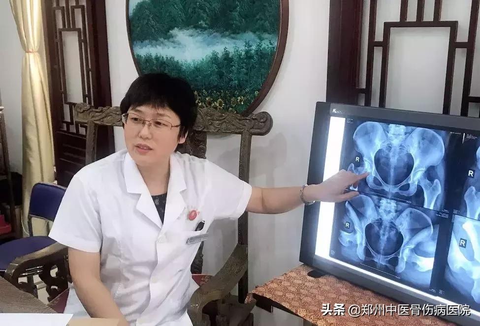 股骨头缺血性坏死有没有奇迹治愈,治愈股骨头坏死需要哪些锻炼