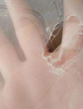 高温天气穿裤袜,夏天穿医用弹力袜太热了怎么办