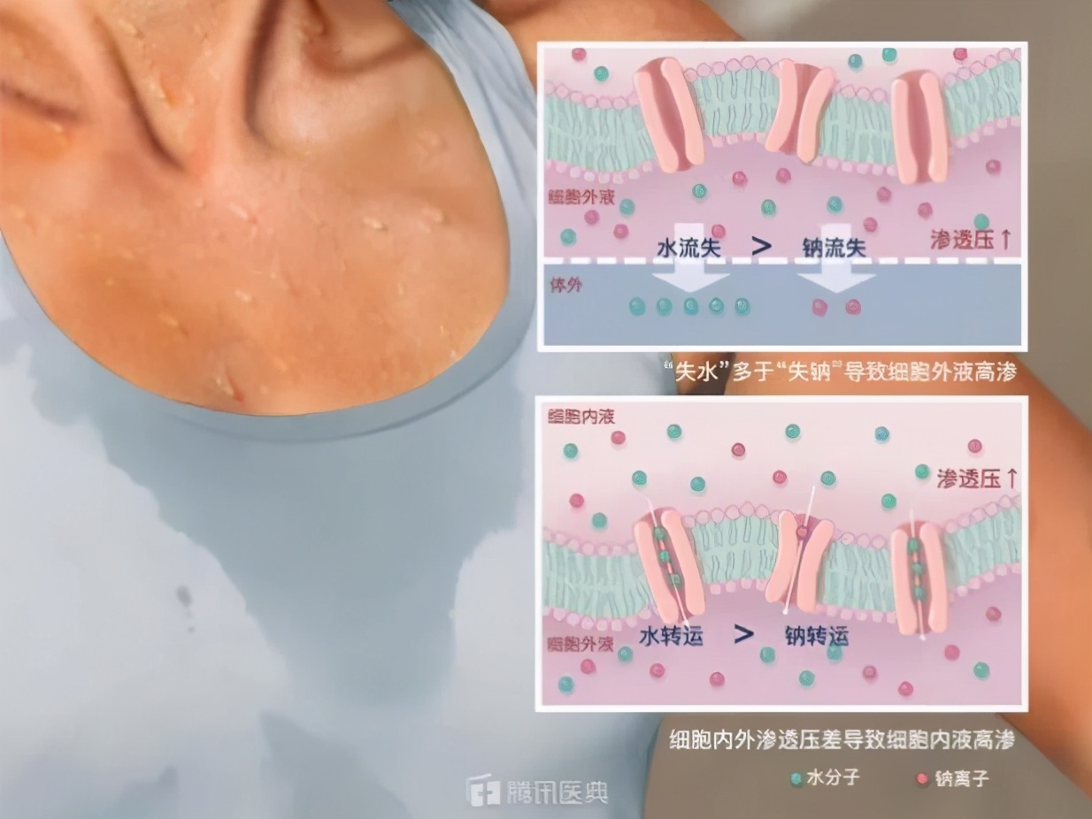 往伤口上撒盐撒辣椒粉,在伤口上撒盐有多疼