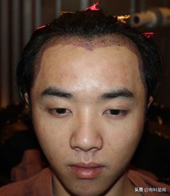 乌龙事件？网曝华晨宇整容网友否认其整容，称照片与前经纪人有关