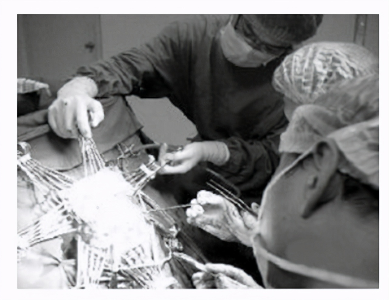 乳腺增生囊肿结节会癌变吗,乳腺囊肿乳房皮肤痒是癌变吗