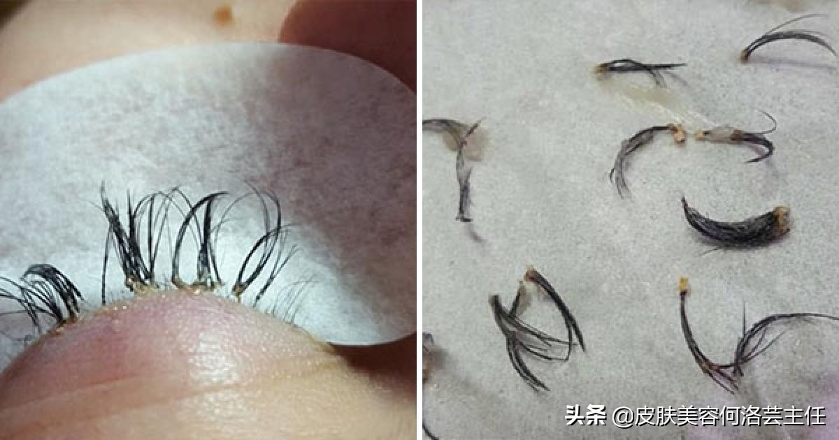 为什么不建议种假睫毛,为什么不介意种浓密睫毛