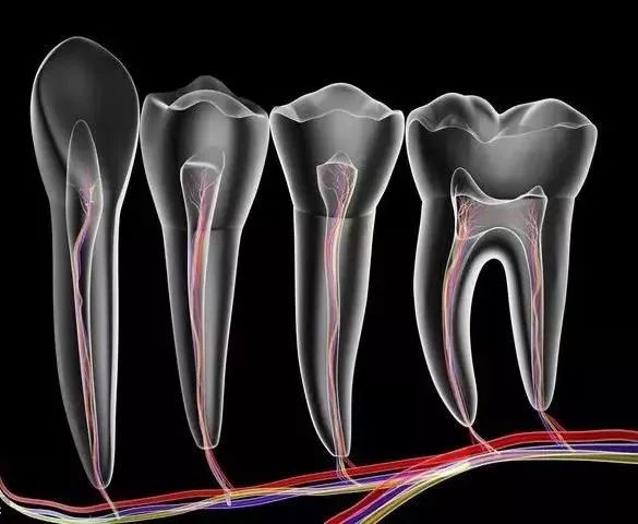牙蛀了必须根管吗,牙蛀到什么程度需要补牙