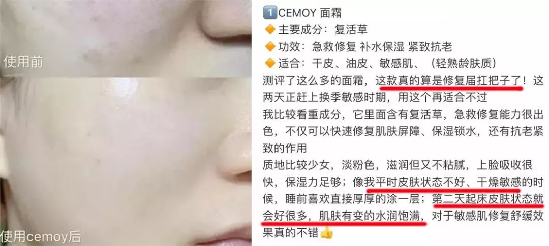 赵露思推荐补水保湿,赵露思推荐水感保湿焕颜面霜