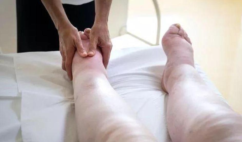 尿酸高通常会引起什么关节痛,尿酸高会引起哪些部位疼痛