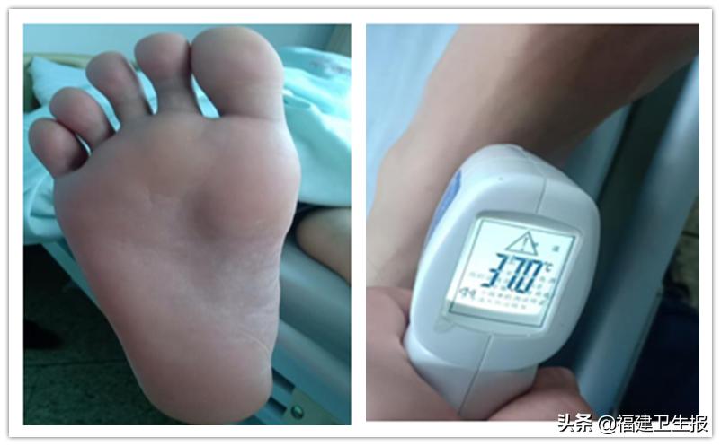 福建一男子醒来腰酸背痛,男子发烧40度汗水湿透床
