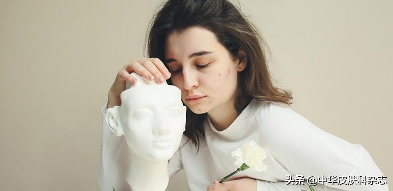 战痘全攻略,战痘全攻略详解