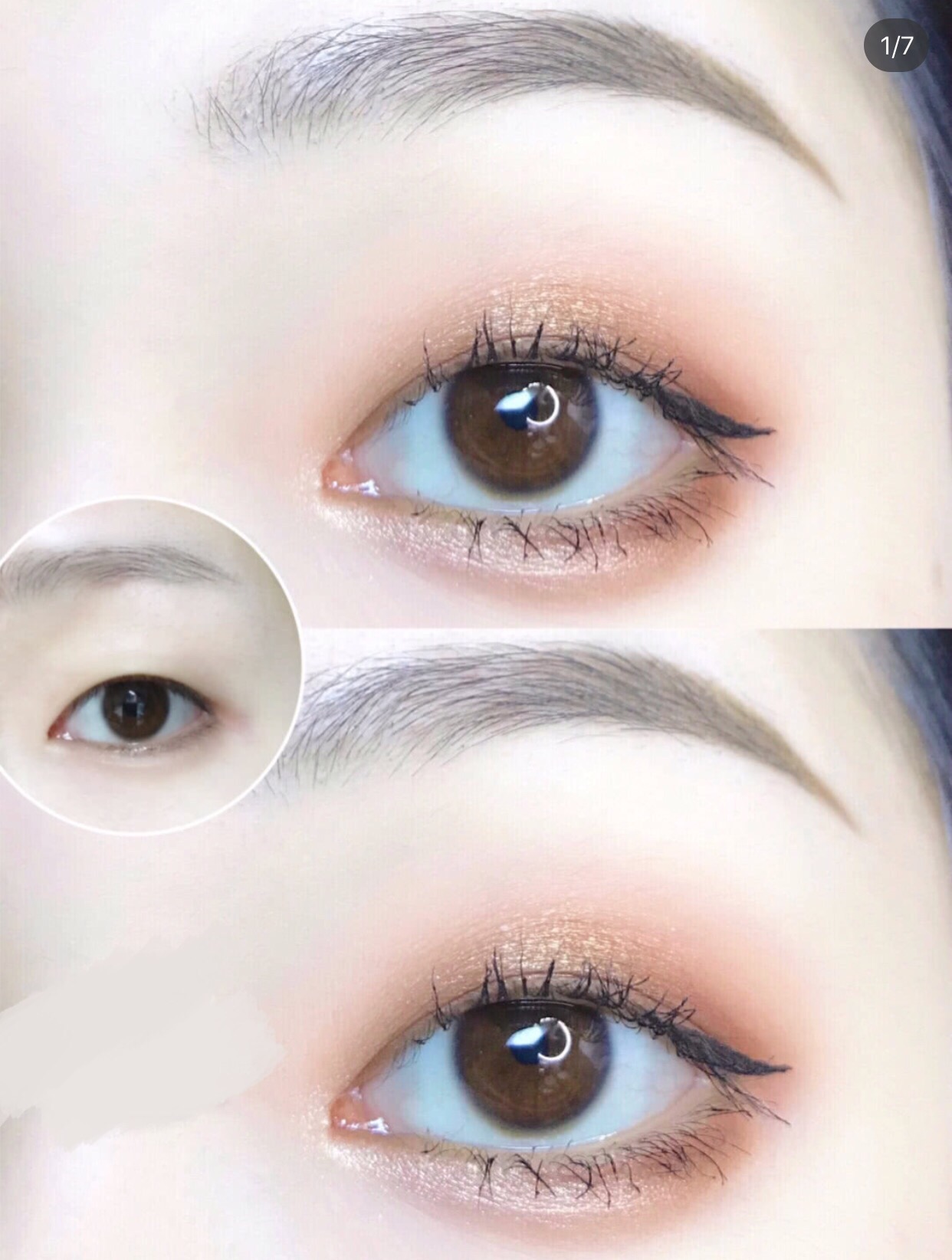 单眼皮浮肿变双眼皮怎么恢复正常,单眼皮眼皮无力怎么改善